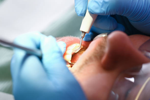 Best Emergency Broken Tooth Repair in Elmwood Park, IL